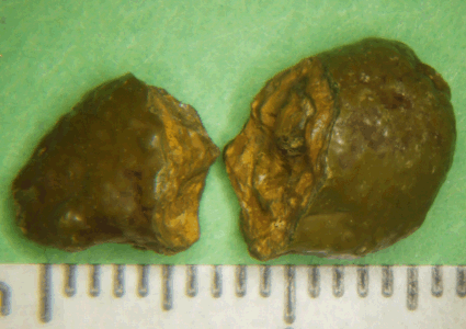 Canine store urate stones